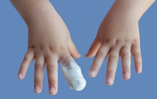 Pediatric & Congenital Procedures & Conditions - DFW Hand Surgeon William Van Wyk