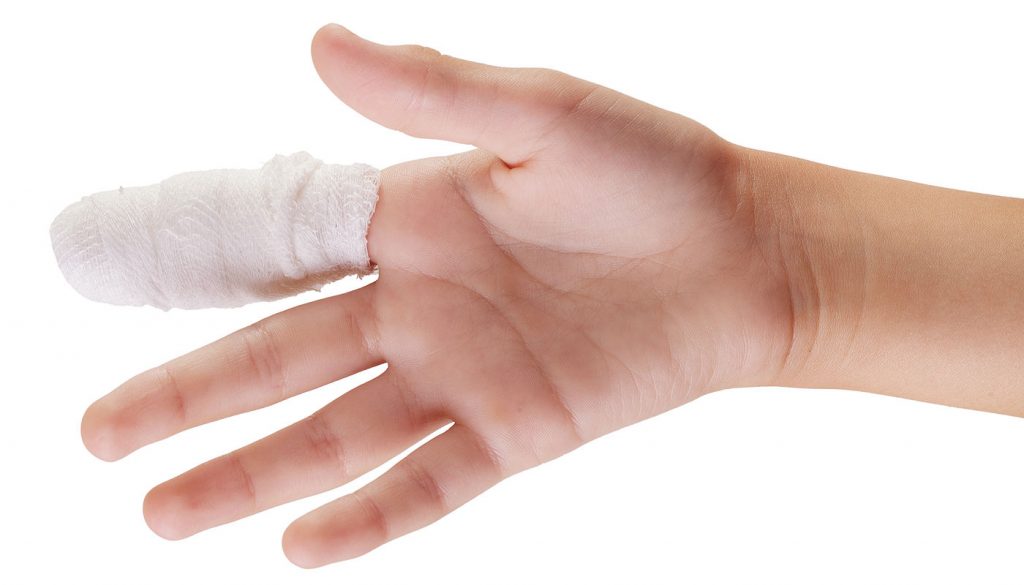 Hand and Fingers Procedures - DFW Hand Surgeon Dr William Van Wyk