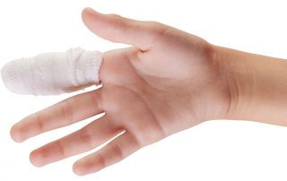 Hand and Fingers Procedures - DFW Hand Surgeon Dr William Van Wyk