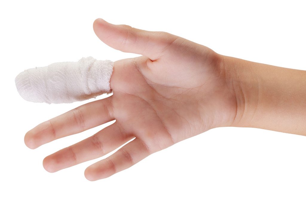 Hand and Fingers Procedures - DFW Hand Surgeon